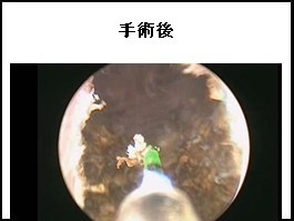 edcd2fa817589937ddc3be85645c2c0d-1721184675.jpg